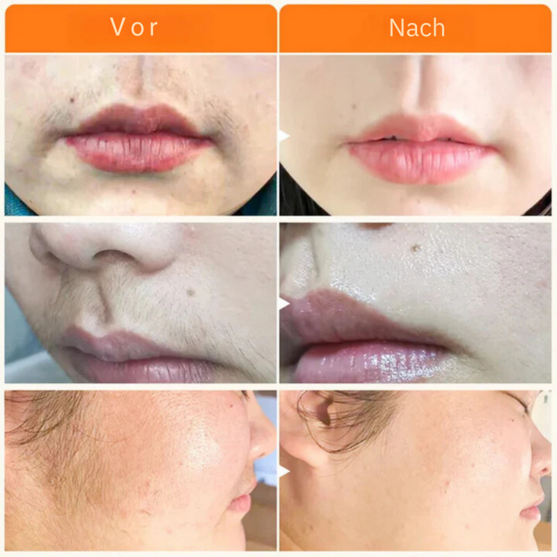HairVanish™ | 100% naturlige ingredienser!