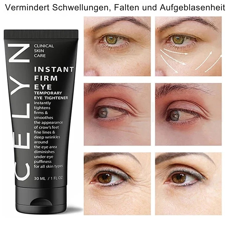 Celyn™ | Rynkefri og stram på sekunder