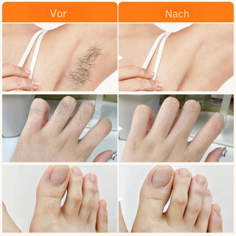 HairVanish™ | 100% naturlige ingredienser!