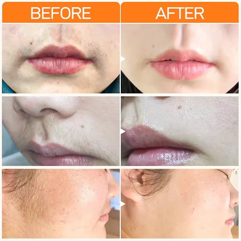 Silkura™ | 100 % Naturlig!